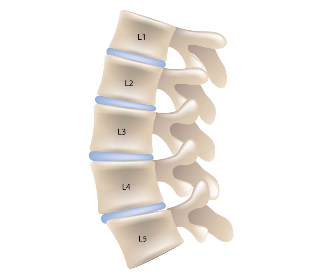 A lumbar spine from a side view, L1-L5
